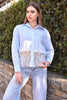 Lace Detail Striped Shirt